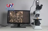 Motorized Stage Auto-Scan Autofocus Biological Microscope Optical 1920x1080 Resolution LCD Display Metallographic Scanner