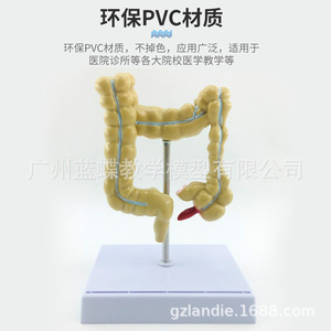 Modèle humain de petite maladie du côlon ; modèle de côlon en proctologie et gastroentérologie ; côlon en gastroentérologie ; intestin. - Product Image 5