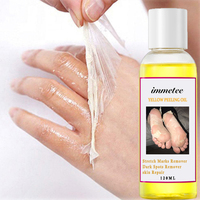 Huile Peeling Jaune Extra Forte 120ml Marque Blanche – Éclaircissante et Exfoliante pour le Corps, Élimine les Taches Brunes et les Vergetures