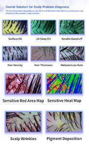 เครื่องวิเคราะห์หนังศีรษะแบบพกพาไร้สาย รุ่นใหม่ พร้อม AI และวัสดุ ABS ระบบตรวจจับหนังศีรษะด้วย AI - Product Image 3