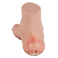 Modelo de Úlcera del Pie Diabético Pro-Health, Etapas Leves y Severas, Material de Silicona, Modelo Anatómico Educativo para Entrenamiento Médico Hospitalario