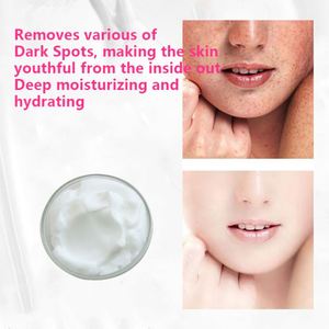 Crema Blanqueadora, Corrector de Manchas Oscuras para Rodillas y Nudillos, Crema Blanqueadora para Axilas, Fabricante de Cosméticos Directo - Product Image 2