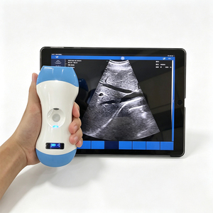 Escáner de Ultrasonido Inalámbrico Portátil Sin Cables para Servicio de Clínica Móvil, Descarga y Almacenamiento de Informes de Exámenes de Pacientes - Product Image 4