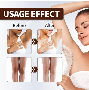 <span class=keywords><strong>Meilleure</strong></span> <span class=keywords><strong>crème</strong></span> pour le soin du visage, éliminant les taches brunes, les taches brunes sur les cuisses intérieures, <span class=keywords><strong>crème</strong></span> éclaircissante pour la peau noire - Product Image 2