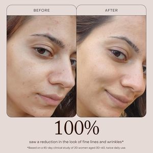 ETRUN ALISA Huile Pure Éclat Anti-Âge à la Rose Musquée, Réduit Visiblement les Rides et Ridules en Profondeur - Product Image 4
