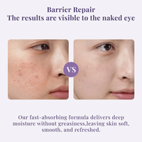 Gel de collagène recombinant de type III, hydratation intense, réparation de la barrière cutanée, soin esthétique médical professionnel après procédure