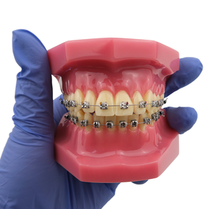 Modelo de Tipodonto Dental de Ortodoncia Smiledental TM-B6-01 con Soportes Metálicos, Ayuda Didáctica de Resina para Entrenamiento Oral - Product Image 1