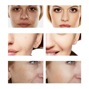 Suero Facial Hidratante Antienvejecimiento con Ácido Hialurónico, Colágeno y Niacinamida para SPA y Salón de Belleza, Marca Privada OEM/ODM - Product Image 5
