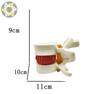 Sains medis Lumbar Disc Herniation Simulator tulang belakang Vertebral Model - Product Image 2