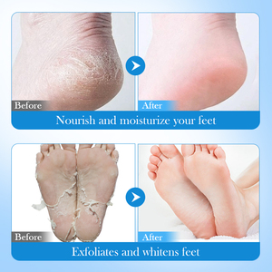 ODM FAYANKOU marque privée avocat gelée de pétrole masque pour les pieds nourrissant anti-fissuration produits de soins des pieds lisses - Product Image 3