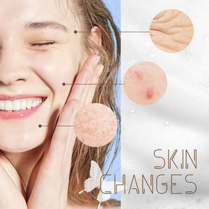 OEM/ODM Fabricantes Jabón de baño Natural Orgánico Piel Blanqueamiento Cara Cuerpo Baño Limpieza Hecho a mano <span class=keywords><strong>Barra</strong></span> de jabón de miel - Product Image 5