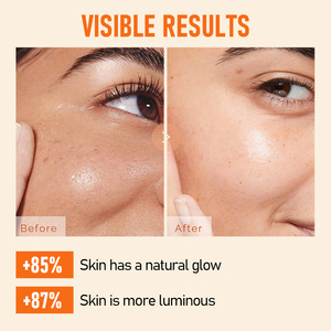 Vitamine C Niacinamide Crème de <span class=keywords><strong>jour</strong></span> <span class=keywords><strong>SPF</strong></span> Marque privée Produits naturels de soin de la peau Protect Blanchissant Éclaircissant Anti-âge Crème pour le visage - Product Image 6