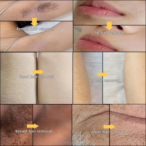 เครื่องกำจัดขนขาและบาซู กำจัดขนถาวร กำจัดขนได้ดีที่สุด เครื่องกำจัดขนด้วยไฟฟ้า - Product Image 4