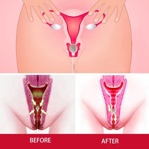Set de Perlas Yoni de Marca Privada, Perlas Yoni Desintoxicantes y Tampones de Limpieza Vaginal - Product Image 3