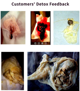 Chinaherbs Mujeres Salud Útero Curación Vagina Limpieza Ayuda a aumentar la fertilidad Yummy Inature Yoni Pearls Posparto - Product Image 5