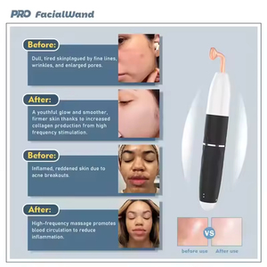Dispositivo De Belleza Facial Inalámbrico 7 en 1 De Alta Frecuencia Para Rejuvenecimiento De La Piel Recargable y Portátil - Product Image 4