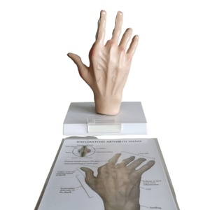 Démonstrato clinique de main de simulateur de pathologie pour l'enseignement orthopédique et rhumatologique - Product Image 6