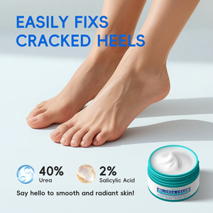 Crema Reparadora Exfoliante e Hidratante LAKOU con 40% de Urea y 2% de Ácido Salicílico para Pies, Manos, Codos y Talones - Product Image 2