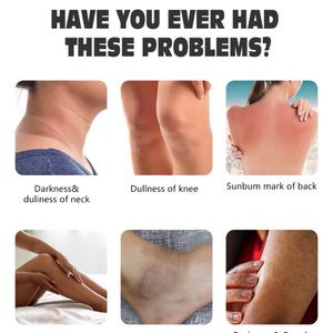 Pegatinas Personalizadas para Crema Blanqueadora de Piel, Etiquetas Privadas, Crema Aclarante, Suavizante, Tonificante - Product Image 2