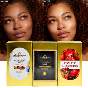 Savon à l'acide kojique au beurre de karité blanchissant pour l'acné biologique fait à la main - Product Image 2