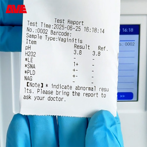 Clínicas De Detecção De Patógenos Sangue Oculto <span class=keywords><strong>Fecal</strong></span> Analisador De Substâncias Químicas Analisador De Substâncias Químicas - Product Image 4