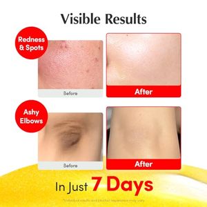 Sérum Visage Illuminateur aux Vitamines 30ml – Soin Liquide Bio aux Herbes avec Niacinamide, Glycérine et Oligopeptides - Product Image 5