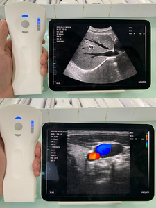 Suresult <strong>Handheld</strong> Ultrasound <strong>Doppler</strong> 18 Frames High Speed Clear Image Linear/convex Head Portable Wireless Ultrasound - Product Image 5