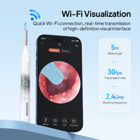 Prix de liquidation : Outil de nettoyage d'oreilles avec caméra Wi-Fi, Endoscope pour cérumen