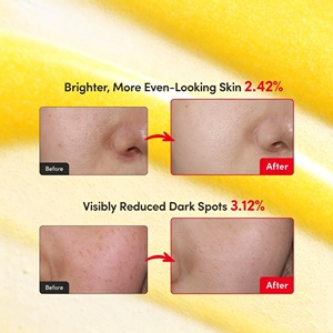 Suero Facial Iluminador ETRUN ALISA con Vitamina C, Niacinamida <span class=keywords><strong>y</strong></span> Ácido Tranexámico para Reducir Manchas Oscuras <span class=keywords><strong>y</strong></span> Reparar la Barrera Cutánea OEM ODM - Product Image 4