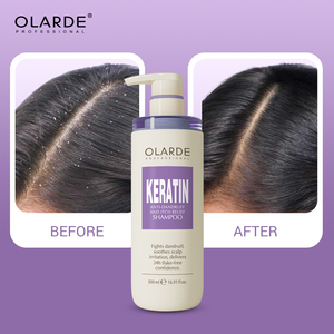 Set Profesional <span class=keywords><strong>para</strong></span> el Cuidado del <span class=keywords><strong>Cabello</strong></span> <span class=keywords><strong>con</strong></span> Queratina, Reparación Profunda, Calma el Cuero Cabelludo, Anticaspa, Antipicazón, Champú y Acondicionador <span class=keywords><strong>para</strong></span> <span class=keywords><strong>Cabello</strong></span> Dañado - Product Image 5