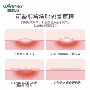 Pansements hydrocolloïdes Steady/Health pour pansements humides, abrasions, plaies postopératoires, cicatrisation des escarres et absorption. - Product Image 3