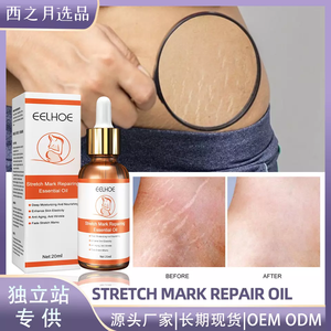 <span class=keywords><strong>Huile</strong></span> pour l'élimination des vergetures avec logo personnalisé crème pour l'élimination des cicatrices pour femmes enceintes crème pour l'élimination des vergetures - Product Image 5