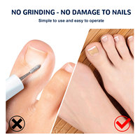 Autocollants de correction des ongles et patchs de soin pour l'art des ongles, baume pour les ongles incarnés du pied