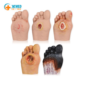 Maniquí de pie diabético para entrenamiento médico, 5 piezas, tamaño real humano, material PVC, origen Henan, marca Yulin, modelos niveles 1-5 para exhibición - Product Image 1
