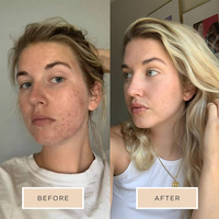 Marque privée Tonique pour le visage Eau de rose biologique naturelle Eau de rose agua de rosas Brume pour le visage Spray hydratant pour les soins de la peau Eau de rose