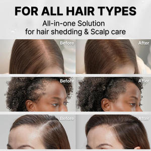 Aceite Vegano con Péptidos Orgánicos para el Tratamiento del Cabello, Reparación Capilar de Efecto Rápido y Suero para el Cuero Cabelludo para Personas que Sufrirían Pérdida de Cabello - Product Image 6