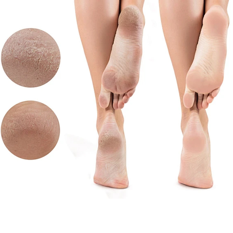 Trending Daily Needs Foot Masking Socks