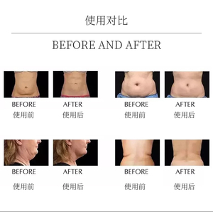 Professional 9-in-1 Body Sculptor with Multiple Handles, Effective Fat Removal & Anti-aging Device <b>for</b> Commercial and Home Users - Product Image 3