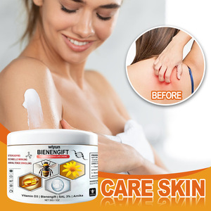 Offres Spéciales crème de soin au venin d'abeille Ximonth soulagement du psoriasis eczéma réparateur <span class=keywords><strong>Anti</strong></span> démangeaisons crème <span class=keywords><strong>anti</strong></span>-psoriasis nourrissante - Product Image 3