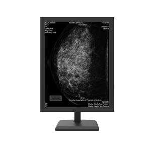 OEM 의료 3MP 그레이 스케일 유방 조영술 진단 디스플레이 LCD 모니터 - Product Image 5