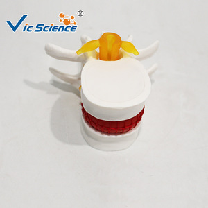 Modelo de demostración de hernia de disco lumbar, esqueleto vertebral espinal médico, material didáctico de patología, venta al por mayor desde - Product Image 4