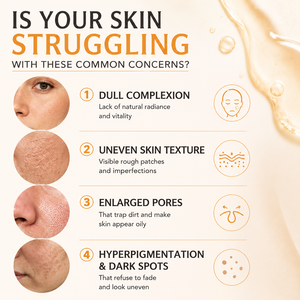 Suero Exfoliante de Ácido Kójico y Cúrcuma 80ml con 3% de Niacinamida AHA BHA Corrector de Manchas Oscuras Suero Facial Iluminador para Mujeres - Product Image 5