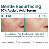 Sérum facial à l'acide azélaïque à 10%, à l'acide kojique et à l'arbre à thé, anti-âge, réducteur de rides, acide hyaluronique hydratant, soin des taches, soins de la peau coréens