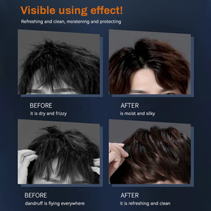 Mulan nam chống gàu nuôi dưỡng dầu gội với <span class=keywords><strong>Selenium</strong></span> disulfide <span class=keywords><strong>gel</strong></span> để giảm ngứa và gàu - Product Image 5