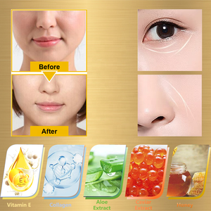 Non-Silicone Blanchiment Beauté Peau Peel Off Masque Vitamine E Anti-Rides Sourire Lisse Rides Lignes Patchs Du <span class=keywords><strong>Visage</strong></span> - Product Image 5