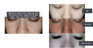 Máquina Analizadora de Piel Profesional AISIA Q1, Pantalla HD de 15.6 Pulgadas, 36MP, 17 Idiomas, para Clínicas, Spas y Salones de Belleza, con Tecnología Deep Seek - Product Image 6