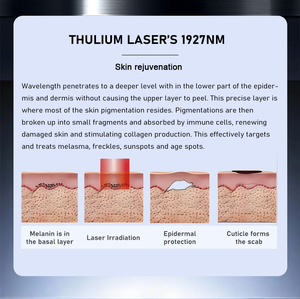 Máy trị liệu rạn da bằng laser Thulium Fractional 1927nm chuyên nghiệp, làm trẻ hóa da, công suất 20W, dùng cho spa/thương mại - Product Image 5
