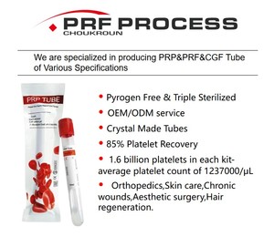 Tubos de PRP de 10 ml para Sistema de PRP con Anticoagulante (ACD-a) y Gel de Separación, Tubos de Vacío para Separación de PRP para <span class=keywords><strong>Veterinaria</strong></span> (Paquete de 50) - Product Image 6