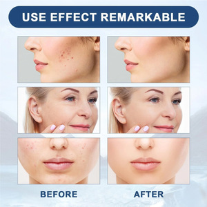 Suero en Ampollas OEM/ODM con NAD+ (Niacinamida) y Ácido Hialurónico para el Rostro, Antienvejecimiento, Reparación de la Piel, Iluminador e Hidratante - Negro Oscuro - Product Image 3