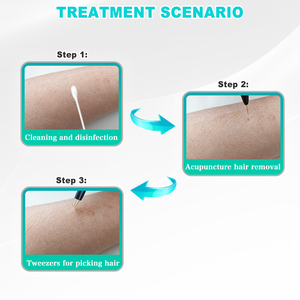 Giá bán buôn kim-rụng lông không đau tóc loại bỏ điện máy với kim * 10 cái cho tự sử dụng - Product Image 4